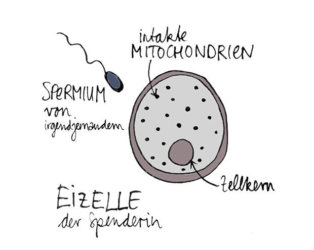 Gleichzeitig wird die Eizelle einer anonymen Spenderin mit gesunden Mitochondrien von, zum Beispiel dem leiblichen Vater, im Labor ebenfalls befruchtet