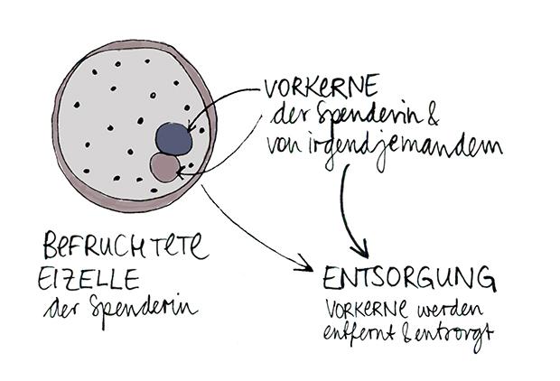 Der Spender-Embryo (ob die Bezeichnung „Embryo“ hier zutrifft, darüber streiten die Experten) wird lediglich für die Gewinnung von „Biomaterial“, also gesunden Mitochondrien benötigt. Die Vorkerne der Spender-Eizelle werden daher entfernt und entsorgt