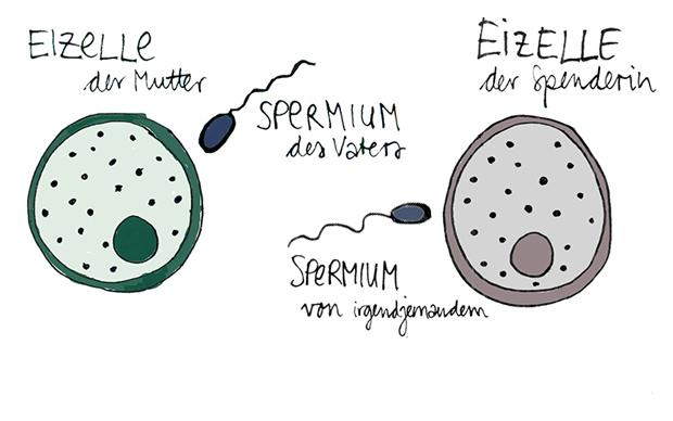 Die nun zugelassenen Gentechniken zur Verhinderung von Mitochondriopathie sind nicht ohne. Die folgenden Grafiken erklären eine davon: Den Transfer der Vorkerne der leiblichen Mutter und des Vaters in die gesunde Eizelle einer Spenderin