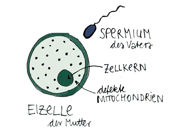 Die Eizelle der leiblichen Mutter besitzt wie jede andere menschliche Zelle tausende kleine Energiemotoren, sogenannte Mitochondrien. Sind diese defekt und produzieren nicht ausreichend Energie für die Zellen, ist das Risiko der Weitervererbung groß