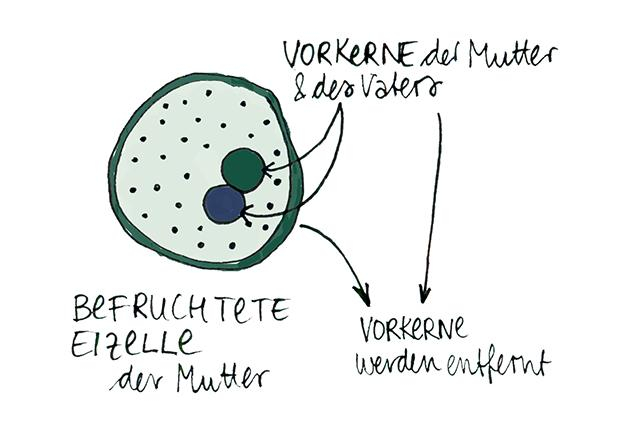 Das Ziel der neuen Methode ist es, die Vererbung dieses Gendeffekts (Mitochondriopathie) zu verhindern. Hierfür wird das Erbgut der leiblichen Mutter und des Vaters (Vorkerne) aus der befruchteten Eizelle mit den defekten Mitochondrien zunächst herausgeno