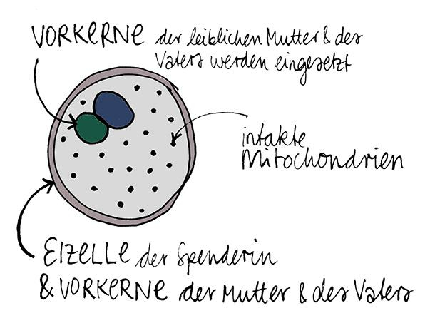 Die Vorkerne der leiblichen Mutter und des Vaters werden dann in die entkernte Eizelle der Spenderin eingesetzt. Der Embryo verfügt so über das Erbgut seiner leiblichen Eltern im Zellkern, während u.a. die intakten Mitochondrien von der Spenderin stammen